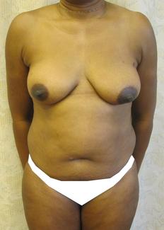 cropped_shaded.jpg cropped_shaded.jpg