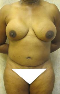 cropped_shaded.jpg cropped_shaded.jpg